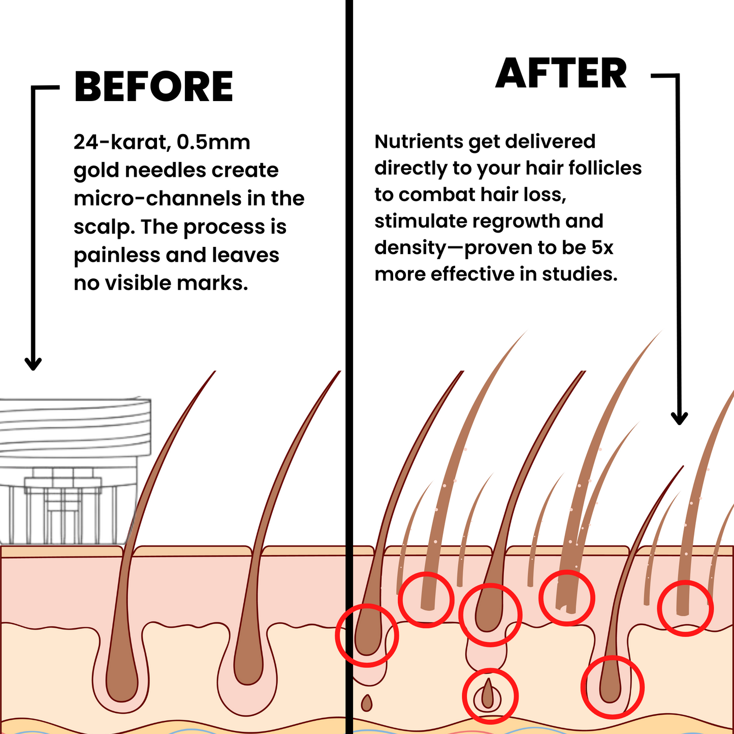 AlphaInfuse Hair Regrowth System